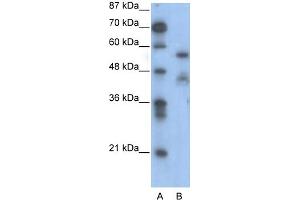 WB Suggested Anti-NFIA Antibody Titration:  0. (NFIA anticorps  (Middle Region))