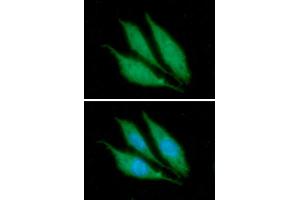 ICC/IF analysis of KRT14 in PC3 cells.