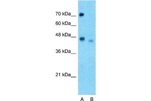 Host:  Rabbit  Target Name:  SOX4  Sample Type:  Hela  Lane A:  Primary Antibody  Lane B:  Primary Antibody + Blocking Peptide  Primary Antibody Concentration:  1ug/ml  Peptide Concentration:  5ug/ml  Lysate Quantity:  25ug/lane/lane  Gel Concentration:  0.