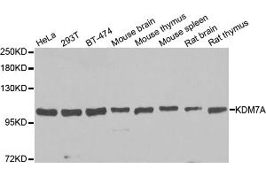 Western blot analysis of extracts of various cell lines, using KDM7A antibody. (JHDM1D anticorps)