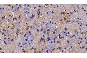Detection of HDAC6 in Mouse Cerebrum Tissue using Polyclonal Antibody to Histone Deacetylase 6 (HDAC6)