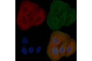 CEP104 Mouse Monoclonal Antibody staining Hela cells by IF/ICC. (KIAA0562 anticorps)