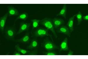 Immunofluorescence analysis of A549 cells using MPG Polyclonal Antibody (MPG anticorps)