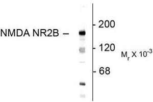 Image no. 1 for anti-Glutamate Receptor, Ionotropic, N-Methyl D-Aspartate 2B (GRIN2B) (N-Term) antibody (ABIN372684) (GRIN2B anticorps  (N-Term))