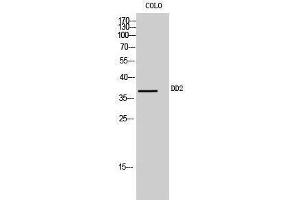 Western Blotting (WB) image for anti-Aldo-keto Reductase Family 1, Member C2 (AKR1C2) (Internal Region) antibody (ABIN6283770)