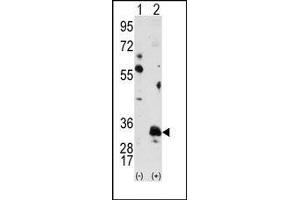 Image no. 2 for anti-Pim-1 Oncogene (PIM1) antibody (ABIN360328) (PIM1 anticorps)