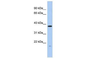 RWDD2A antibody used at 1 ug/ml to detect target protein. (RWDD2A anticorps  (N-Term))