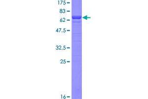 Image no. 1 for Malate Dehydrogenase 1, NAD (Soluble) (MDH1) (AA 1-334) protein (GST tag) (ABIN1310589)