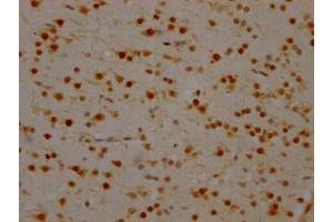 IHC image of ABIN7127546 diluted at 1:100 and staining in paraffin-embedded human brain tissue performed on a Leica BondTM system.