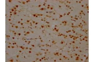 IHC image of ABIN7127546 diluted at 1:100 and staining in paraffin-embedded human brain tissue performed on a Leica BondTM system. (Recombinant SYNCRIP anticorps)