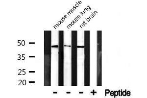 Western blot analysis of extracts from various tissue, using CADM4 antibody. (Cell Adhesion Molecule 4 anticorps  (C-Term))
