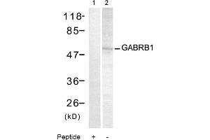 Image no. 1 for anti-gamma-aminobutyric Acid (GABA) A Receptor, Subunit beta 1 (GABRB1) (Ser434) antibody (ABIN319327) (GABRB1 anticorps  (Ser434))