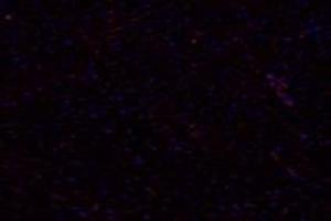 Immunofluorescent analysis of paraformaldehyde-fixed rat heart using,PTGFR (ABIN7075209) at dilution of 1: 800