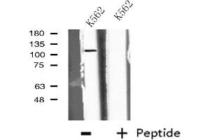 Western blot analysis of extracts from K562 cells, using EPB41L2 antibody. (EPB41L2 anticorps  (Internal Region))