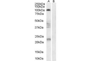 Image no. 1 for anti-Reticulon 4 Receptor (RTN4R) (Internal Region) antibody (ABIN374563) (RTN4R anticorps  (Internal Region))