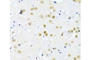 Immunohistochemistry of paraffin-embedded Mouse brain using ITGB3BP Polyclonal Antibody at dilution of 1:100 (40x lens). (ITGB3BP anticorps)