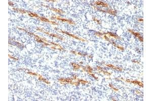 Formalin-fixed, paraffin-embedded human Tonsil stained with CD34 Monoclonal Antibody (QBEnd/10 + HPCA1/763) (CD34 anticorps)