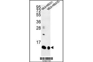 Western blot analysis of SPRR1B Antibody in MDA-MB231, MDA-MB435 cell line lysates (35ug/lane) (SPRR1B anticorps  (C-Term))