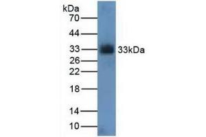 Detection of CDK4 in Rat Kidney Tissue using Polyclonal Antibody to Cyclin Dependent Kinase 4 (CDK4) (CDK4 anticorps  (AA 6-295))