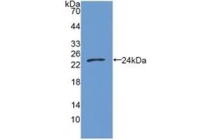 Detection of Recombinant GAS6, Human using Polyclonal Antibody to Growth Arrest Specific Protein 6 (GAS6) (GAS6 anticorps  (AA 136-311))