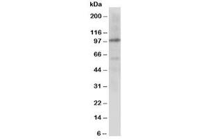 Western blot testing of Cullin 4B antibody and rat lung tissue lysate