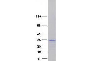Validation with Western Blot