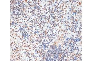 Immunohistochemistry of paraffin-embedded Rat spleen using Phospho-p53(S33) Polyclonal Antibody at dilution of 1:100 (40x lens).