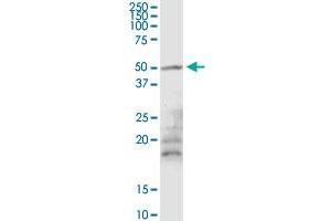 MGRN1 MaxPab rabbit polyclonal antibody. (Mahogunin RING Finger Protein 1 anticorps  (AA 1-576))