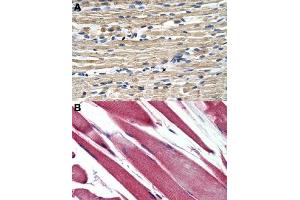 Immunohistochemical staining (Formalin-fixed paraffin-embedded sections) of human skeletal muscle (A, B) with GSTM2 polyclonal antibody . (GSTM2 anticorps  (N-Term))