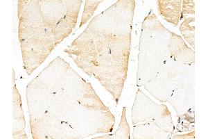 ABIN7094381 and ABIN7098428 at 1/100 staining Mouse muscle tissue by IHC-P. (MYOZ2 anticorps  (Internal Region))