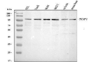 Western blot analysis of Topoisomerase I using anti-Topoisomerase I antibody (ABIN5692844).