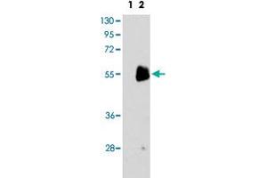 Western blot analysis of PRMT7 (arrow) using PRMT7 polyclonal antibody . (PRMT7 anticorps  (C-Term))