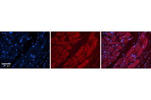 Rabbit Anti-TFB1M Antibody    Formalin Fixed Paraffin Embedded Tissue: Human Adult heart  Observed Staining: Cytoplasmic Primary Antibody Concentration: 1:600 Secondary Antibody: Donkey anti-Rabbit-Cy2/3 Secondary Antibody Concentration: 1:200 Magnification: 20X Exposure Time: 0.