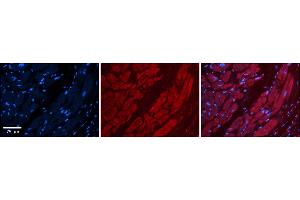 Rabbit Anti-TFB1M Antibody    Formalin Fixed Paraffin Embedded Tissue: Human Adult heart  Observed Staining: Cytoplasmic Primary Antibody Concentration: 1:600 Secondary Antibody: Donkey anti-Rabbit-Cy2/3 Secondary Antibody Concentration: 1:200 Magnification: 20X Exposure Time: 0. (TFB1M anticorps  (N-Term))