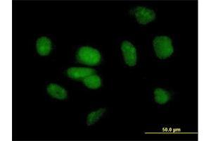 Immunofluorescence of purified MaxPab antibody to PB1 on HeLa cell.