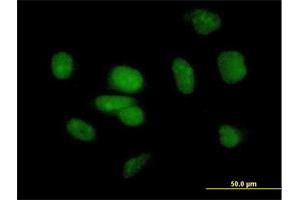 Immunofluorescence of purified MaxPab antibody to PB1 on HeLa cell. (Polybromo 1 anticorps  (AA 1-306))