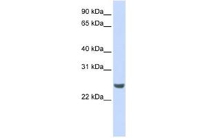 WB Suggested Anti-NKIRAS1 Antibody Titration: 0. (NKIRAS1 anticorps  (N-Term))