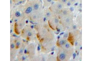 Used in DAB staining on fromalin fixed paraffin-embedded Liver tissue