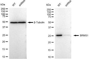 Western blotting analysis using BRMS1 antibody (ABIN7797793).