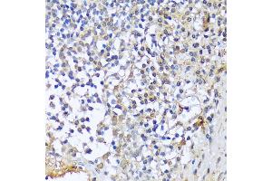 Immunohistochemistry of paraffin-embedded human tonsil using CF antibody (3087) at dilution of 1:100 (40x lens). (A1CF anticorps  (AA 50-120))