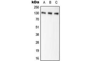 Western blot analysis of Pyruvate Carboxylase expression in HEK293T (A), NIH3T3 (B), H9C2 (C) whole cell lysates. (PC anticorps  (Center))