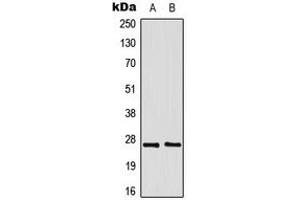 Western blot analysis of GADD153 expression in Jurkat (A), HeLa (B) whole cell lysates. (DDIT3 anticorps  (N-Term))
