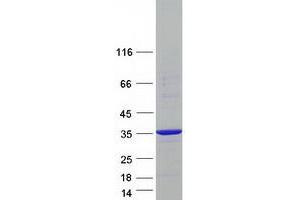 Validation with Western Blot