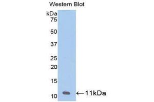 Western Blotting (WB) image for anti-Pro-Platelet Basic Protein (Chemokine (C-X-C Motif) Ligand 7) (PPBP) (AA 59-128) antibody (ABIN3201384) (CXCL7 anticorps  (AA 59-128))