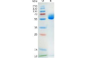 Human SCF Protein, hFc Tag on SDS-PAGE under reducing condition.