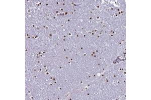 Immunohistochemical staining of human lateral ventricle with LCE6A polyclonal antibody  shows strong nuclear positivity in glial cells. (LCE6A anticorps)