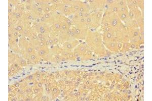 Immunohistochemistry of paraffin-embedded human liver tissue using ABIN7172158 at dilution of 1:100 (THRSP anticorps  (AA 41-144))