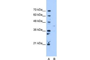 WB Suggested Anti-OAT Antibody Titration:  5. (OAT anticorps  (C-Term))