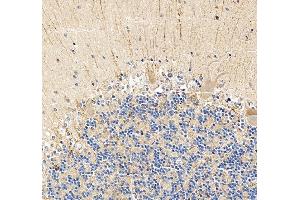 IHC analysis of SHANK3 using anti-SHANK3 antibody (ABIN7600006).