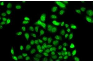 Immunofluorescence analysis of A549 cells using FBXO7 Polyclonal Antibody (FBXO7 anticorps)